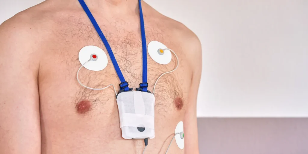 Holter Monitor & Event Recorder